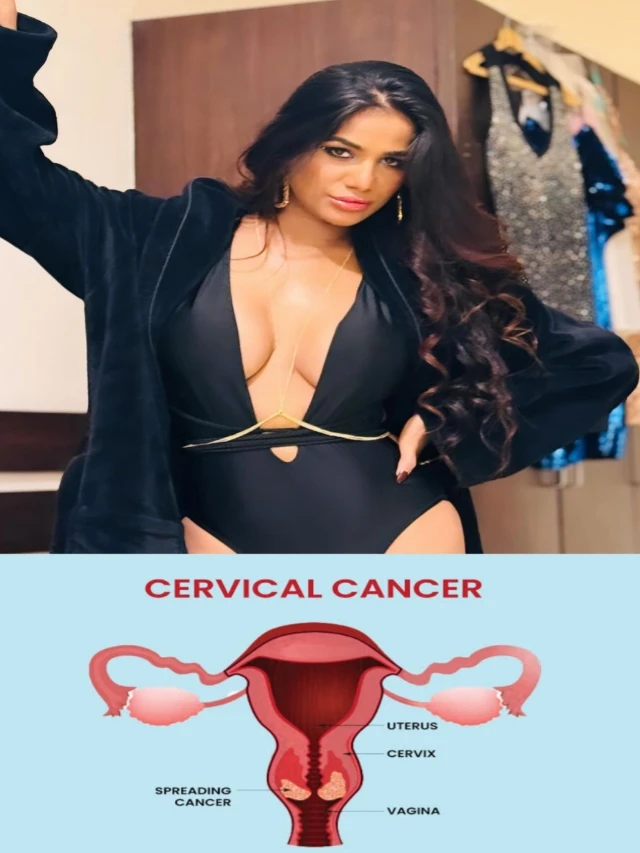 symptoms of cervical cancer due to this poonam pandey died